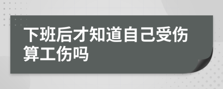 下班后才知道自己受傷算工傷嗎