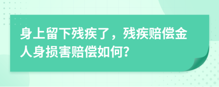 身上留下殘疾了，殘疾賠償金人身?yè)p害賠償如何？