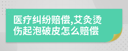 醫(yī)療糾紛賠償,艾灸燙傷起泡破皮怎么賠償