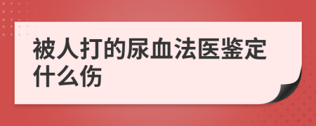被人打的尿血法醫(yī)鑒定什么傷