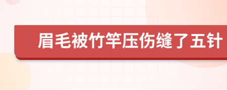 眉毛被竹竿壓傷縫了五針