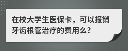 在校大學(xué)生醫(yī)保卡，可以報銷牙齒根管治療的費用么？