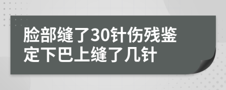 臉部縫了30針傷殘鑒定下巴上縫了幾針