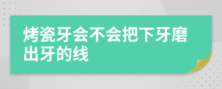 烤瓷牙會不會把下牙磨出牙的線