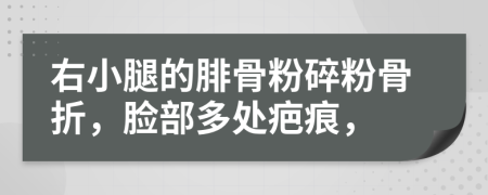 右小腿的腓骨粉碎粉骨折，臉部多處疤痕，
