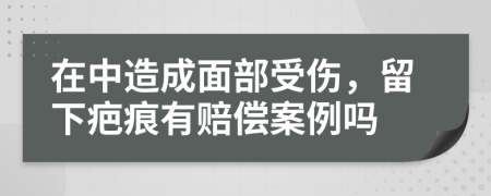 在中造成面部受傷,留下疤痕有賠償案例嗎