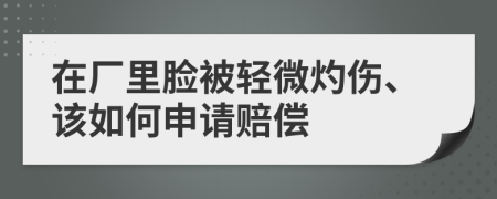 在廠里臉被輕微灼傷、該如何申請(qǐng)賠償