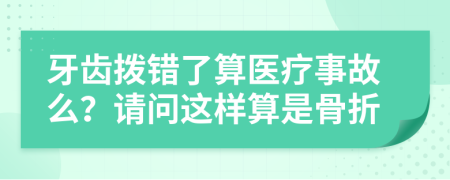 牙齒撥錯(cuò)了算醫(yī)療事故么？請(qǐng)問這樣算是骨折