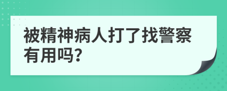 被精神病人打了找警察有用嗎？
