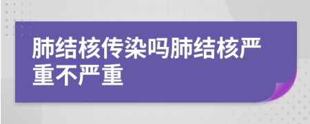 肺結(jié)核傳染嗎肺結(jié)核嚴(yán)重不嚴(yán)重
