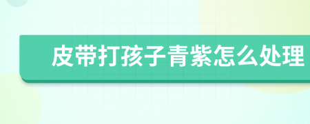 皮帶打孩子青紫怎么處理