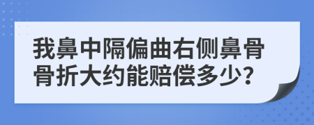 我鼻中隔偏曲右側(cè)鼻骨骨折大約能賠償多少？