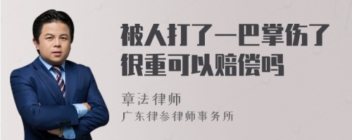 被人打了一巴掌伤了很重可以赔偿吗