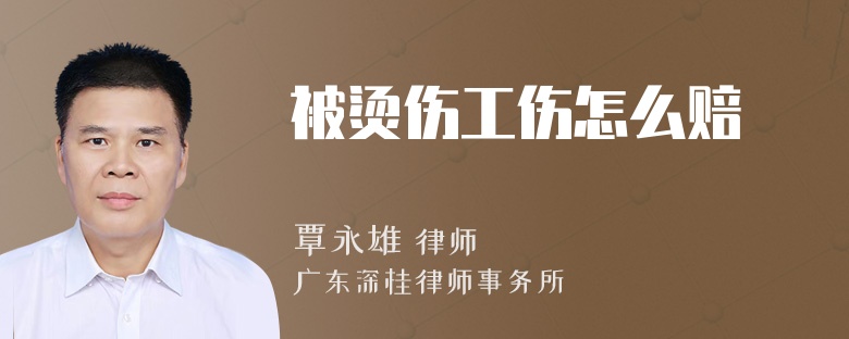 被烫伤工伤怎么赔