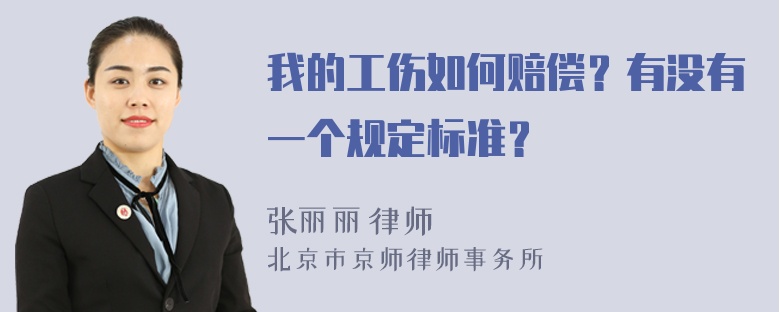 我的工伤如何赔偿？有没有一个规定标准？