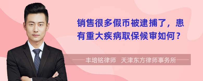 销售很多假币被逮捕了，患有重大疾病取保候审如何？