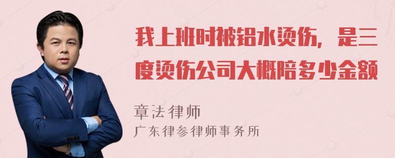 我上班时被铝水烫伤，是三度烫伤公司大概陪多少金额