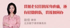 我被老公打的浑身疼痛，还有轻微的伤，我该如何办