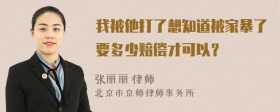 我被他打了想知道被家暴了要多少赔偿才可以？