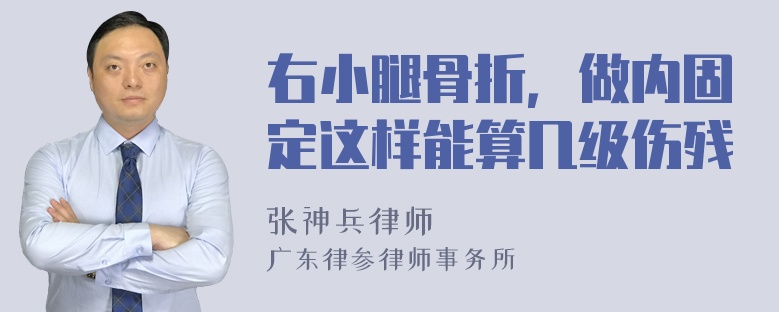 右小腿骨折，做内固定这样能算几级伤残