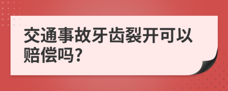 交通事故牙齿裂开可以赔偿吗?