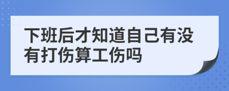 下班后才知道自己有没有打伤算工伤吗