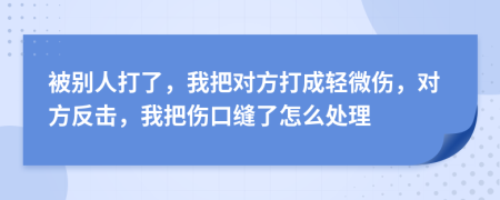 被别人打了，我把对方打成轻微伤，对方反击，我把伤口缝了怎么处理