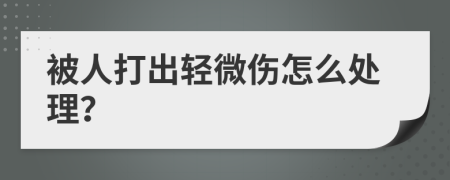 被人打出轻微伤怎么处理？