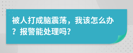 被人打成脑震荡，我该怎么办？报警能处理吗？