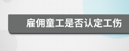 雇佣童工是否认定工伤