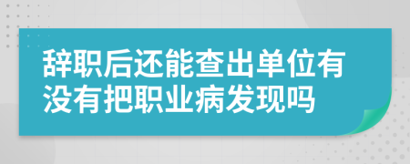 辞职后还能查出单位有没有把职业病发现吗