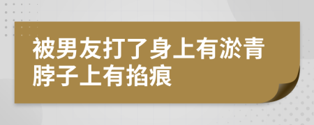 被男友打了身上有淤青脖子上有掐痕