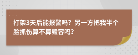 打架3天后能报警吗？另一方把我半个脸抓伤算不算毁容吗？