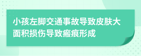 小孩左脚交通事故导致皮肤大面积损伤导致瘢痕形成