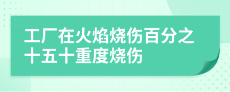 工厂在火焰烧伤百分之十五十重度烧伤