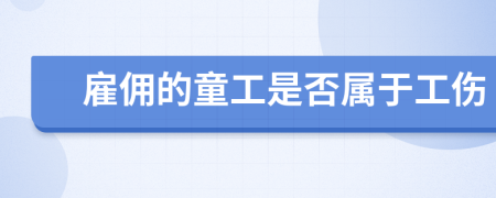 雇佣的童工是否属于工伤