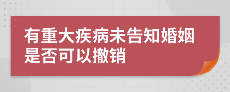 有重大疾病未告知婚姻是否可以撤销