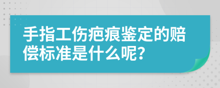 手指工伤疤痕鉴定的赔偿标准是什么呢？