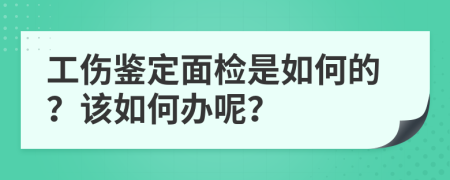 工伤鉴定面检是如何的？该如何办呢？