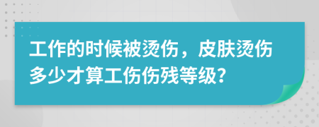 工作的时候被烫伤，皮肤烫伤多少才算工伤伤残等级？