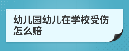 幼儿园幼儿在学校受伤怎么赔