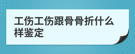 工伤工伤跟骨骨折什么样鉴定