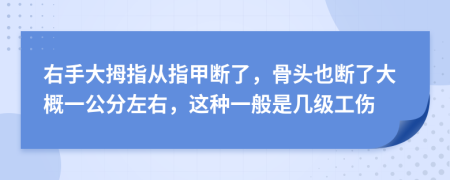 右手大拇指从指甲断了，骨头也断了大概一公分左右，这种一般是几级工伤