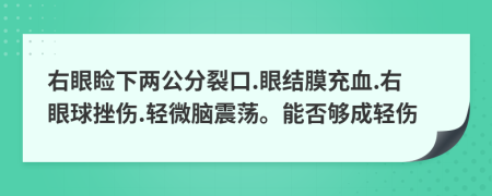 右眼睑下两公分裂口.眼结膜充血.右眼球挫伤.轻微脑震荡。能否够成轻伤