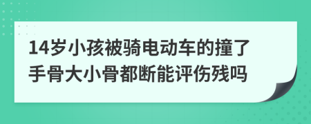 14岁小孩被骑电动车的撞了手骨大小骨都断能评伤残吗