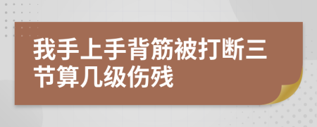 我手上手背筋被打断三节算几级伤残