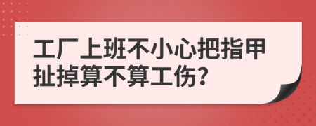 工厂上班不小心把指甲扯掉算不算工伤？