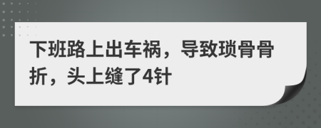 下班路上出车祸，导致琐骨骨折，头上缝了4针