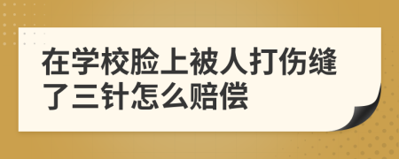 在学校脸上被人打伤缝了三针怎么赔偿