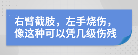 右臂截肢，左手烧伤，像这种可以凭几级伤残